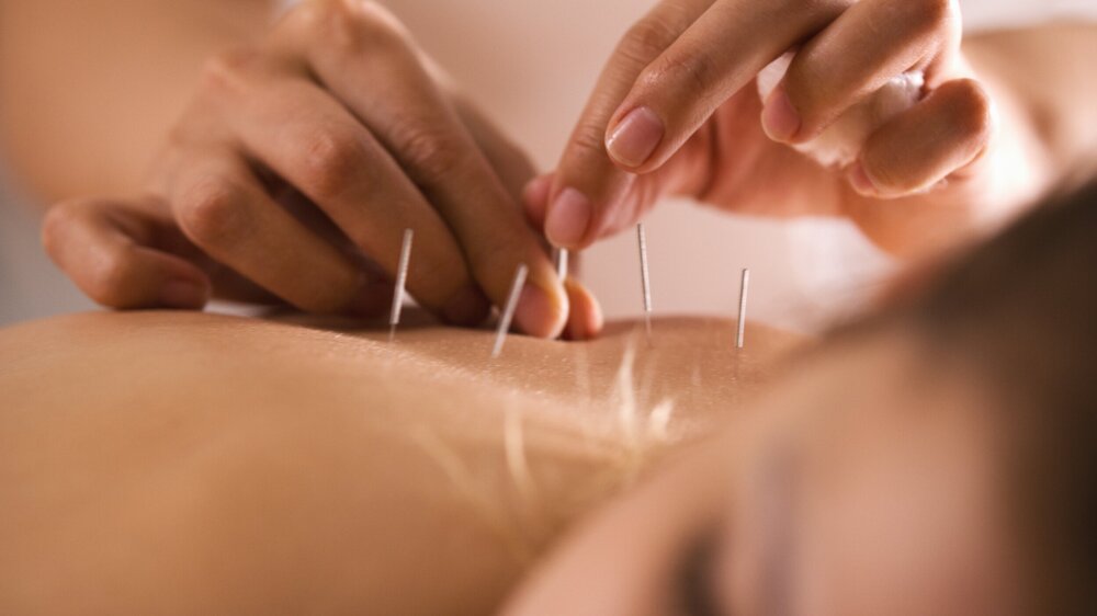 L’acupuncture des 5 éléments